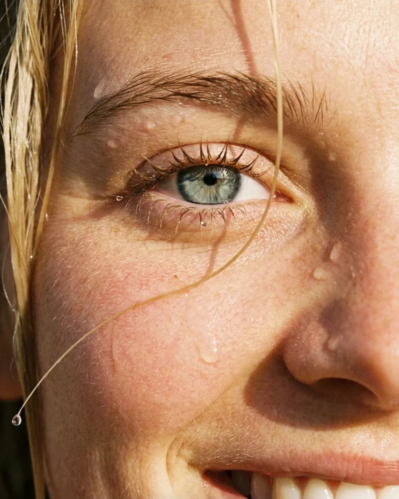 A close-up of skin, shown under the loupe